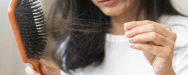 perte de cheveux